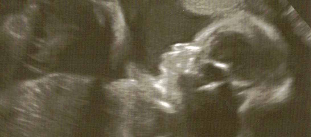 Is it a boy or girl?